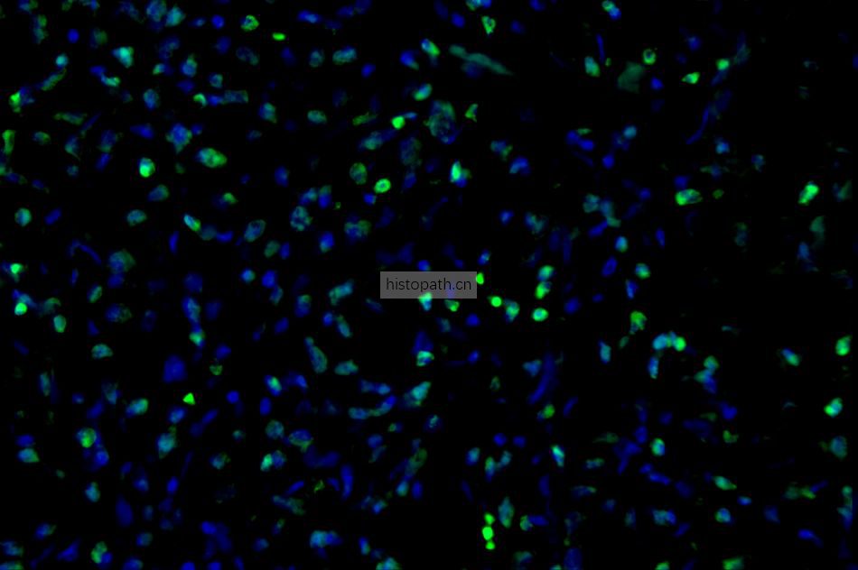 免疫荧光单标双标多标（三标四标五标六标）