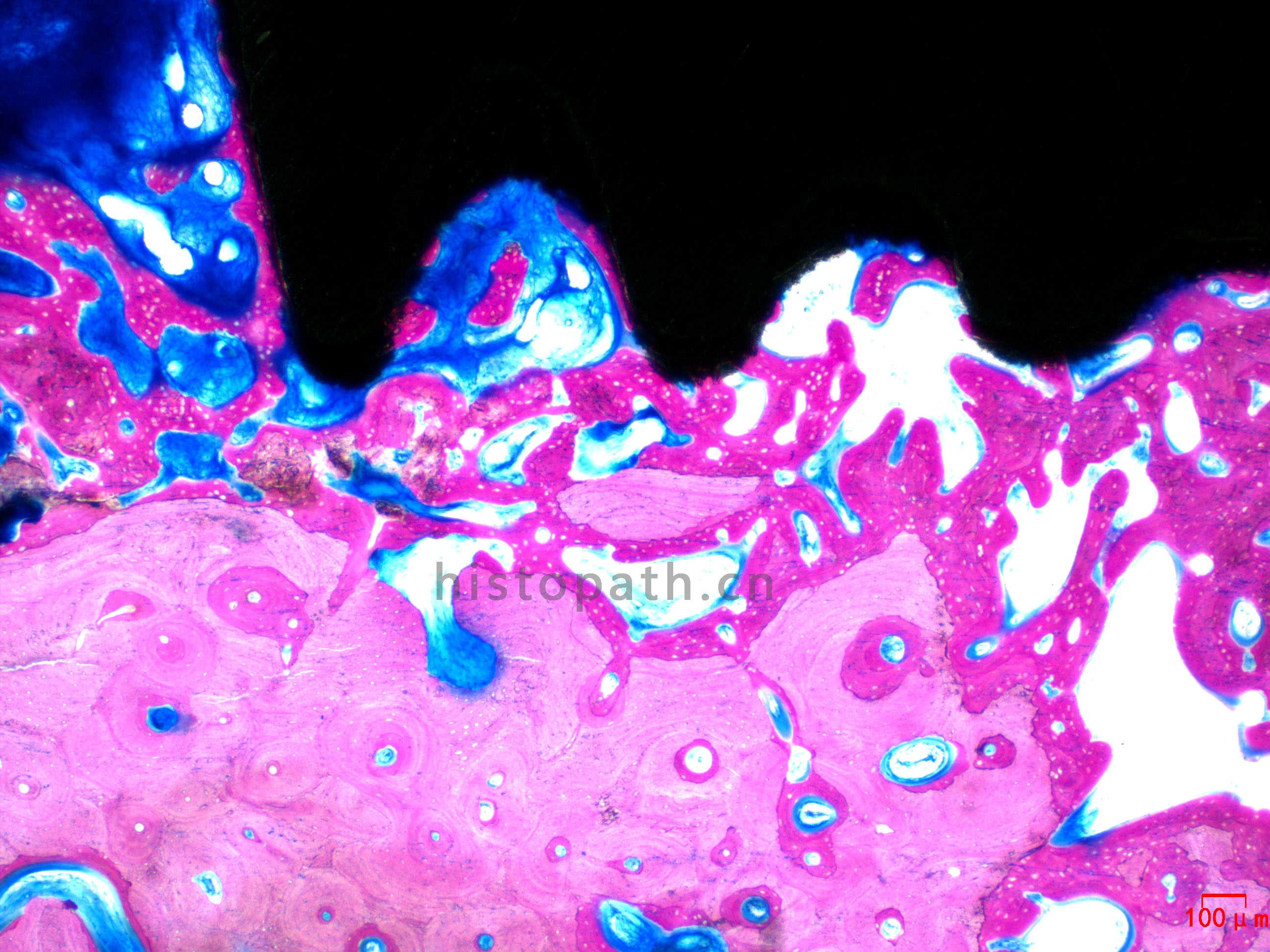 牙种植体亚甲基蓝酸性品红染色.jpg 牙种植体亚甲基蓝酸性品红染色.jpg