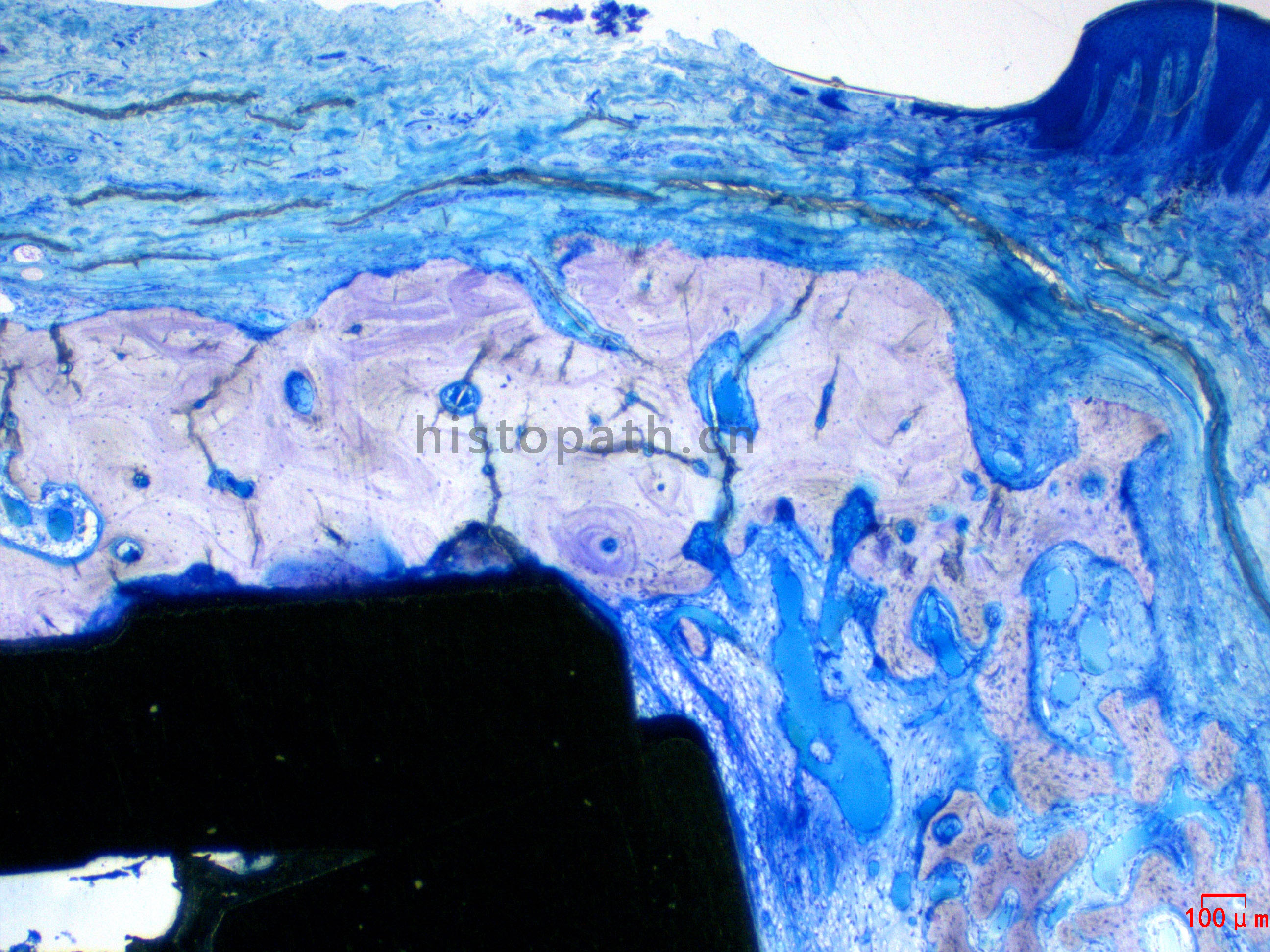 牙种植体甲苯胺蓝染色.jpg 牙种植体甲苯胺蓝染色.jpg