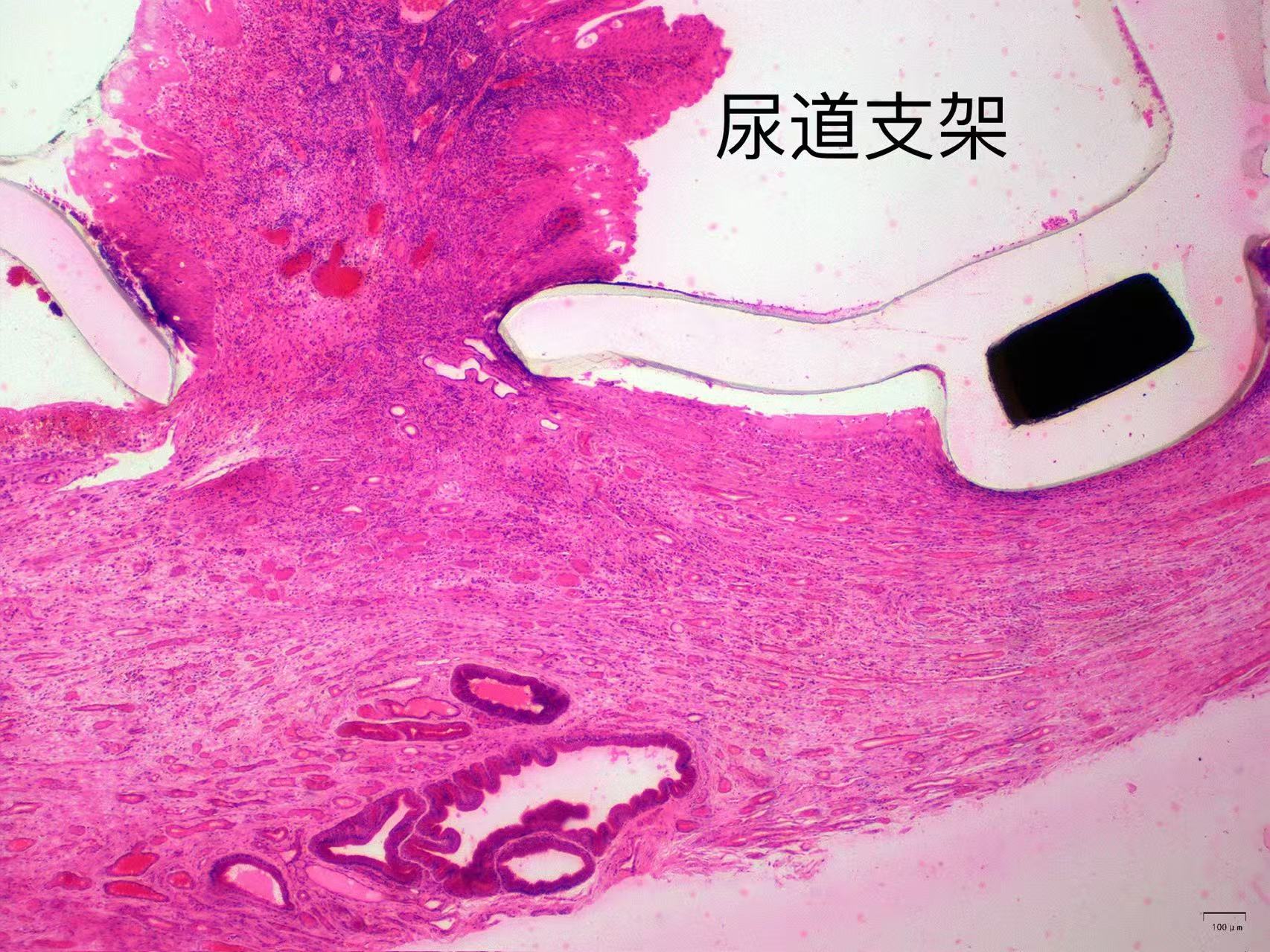 其他支架